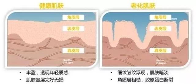 毛孔大脸粗糙用什么方法好（脸上的毛孔粗大怎么改善）-第6张图片-昕阳网